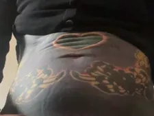Skar 21